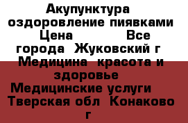 Акупунктура, оздоровление пиявками › Цена ­ 3 000 - Все города, Жуковский г. Медицина, красота и здоровье » Медицинские услуги   . Тверская обл.,Конаково г.
